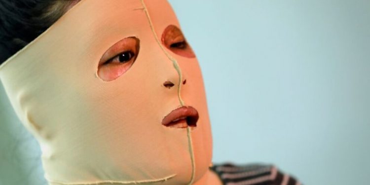 Desfiguradas por machismo, olvidadas por la justicia: Más de 3 mil mujeres agredidas con sustancias corrosivas