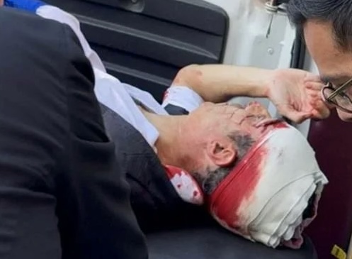 Atentan contra el abogado David Cohen Sacal, exrepresentante de “Billy” Álvarez; se reporta grave