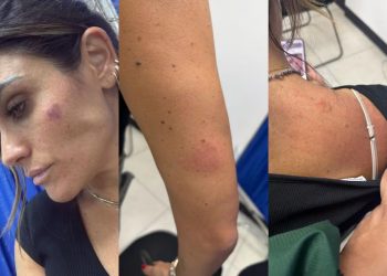 Agreden a alcaldesa Alessandra Rojo de la Vega durante operativo de reordenamiento en San Cosme