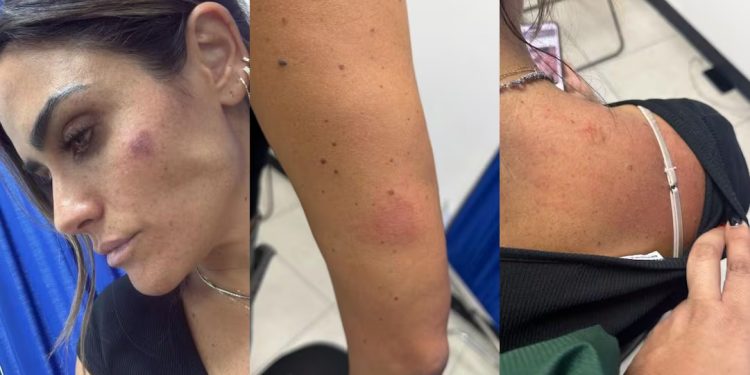 Agreden a alcaldesa Alessandra Rojo de la Vega durante operativo de reordenamiento en San Cosme