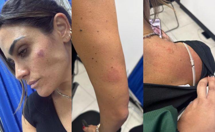 Agreden a alcaldesa Alessandra Rojo de la Vega durante operativo de reordenamiento en San Cosme